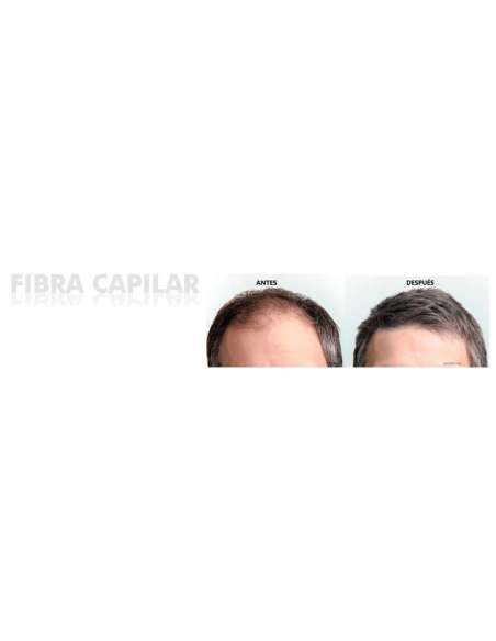 FIBRA CAPILAR